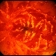Frosted Branch Angiitis